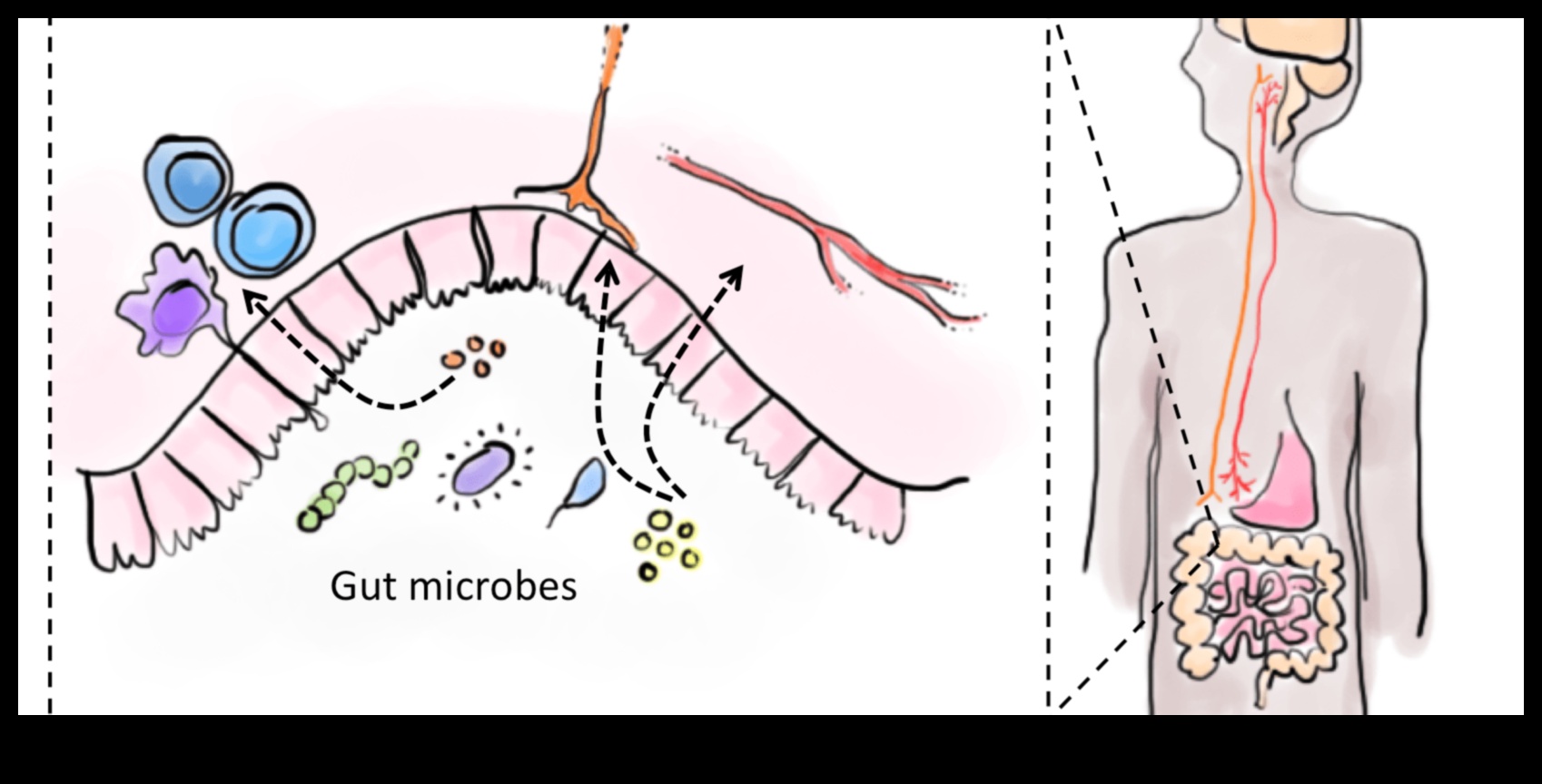 ميكروبيوم الأمعاء: لاعب رئيسي في الجهاز الهضمي المتوازن