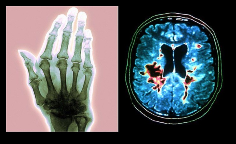 أمراض الجلد الباليو والمناعة الذاتية: استكشاف الروابط